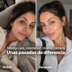 Face Reset PDRN - Del "pareces cansada" al "¿qué te has hecho?" (test)