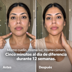 Piel Reset PDRN – Adiós arrugas, hola piel firme y jugosa